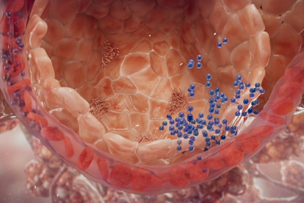 Vantive ECCO2R Mechanism of action by Helix Animation