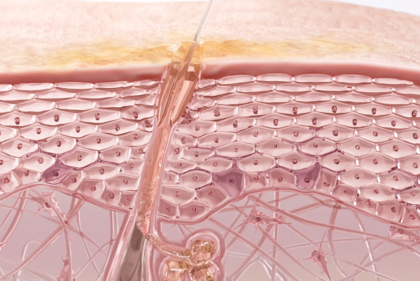 Etat Pur - Acne Actives by Helix Animation