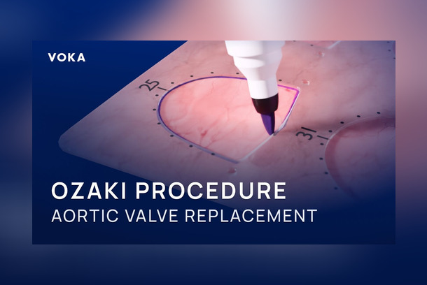 Ozaki Procedure: When the Heart Valve Gets a Fresh Start by VOKA 3D Anatomy & Pathology